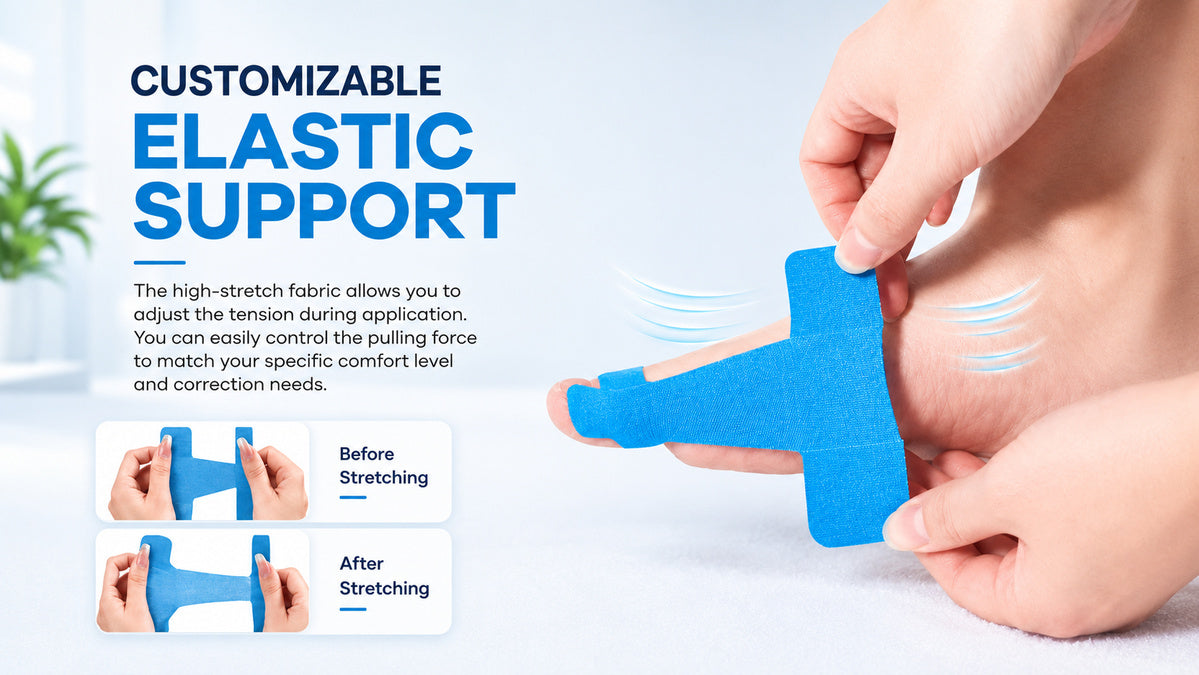 Elastic Support